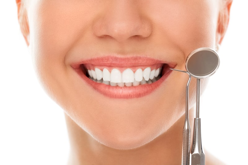 Estética Dental en Málaga