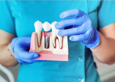 Ortodoncia en Málaga Clínica Dental Fernández de Rota