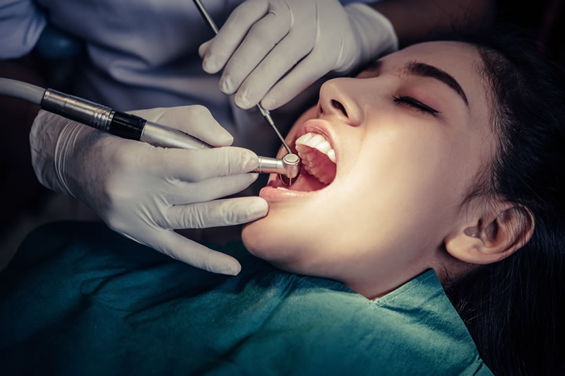 Endodoncias en Málaga