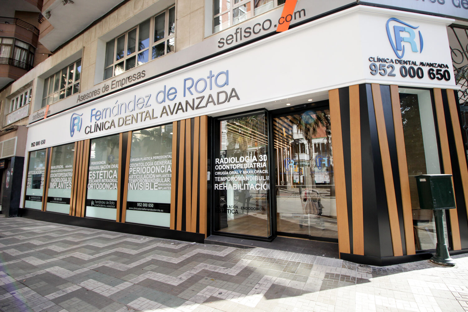 Clínica Dental en Málaga